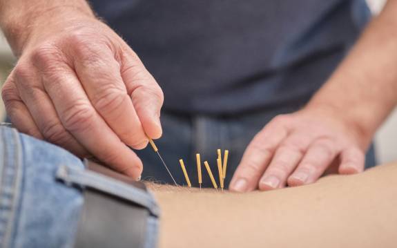 Arzt macht Akupunktur auf Rücken des Patienten